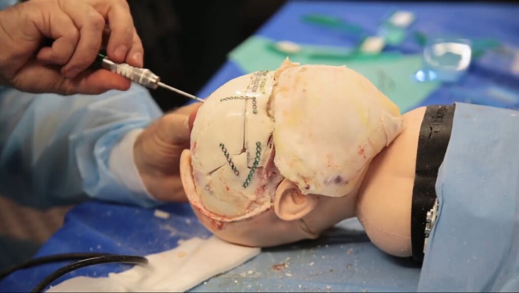 Neurosurgery