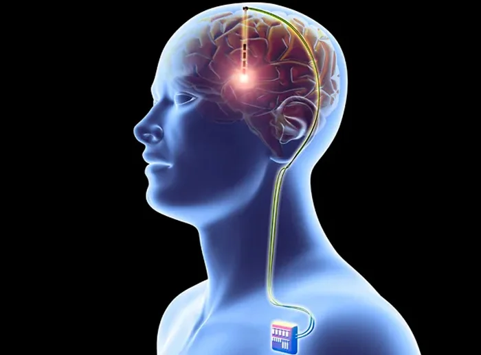 Neurosurgery