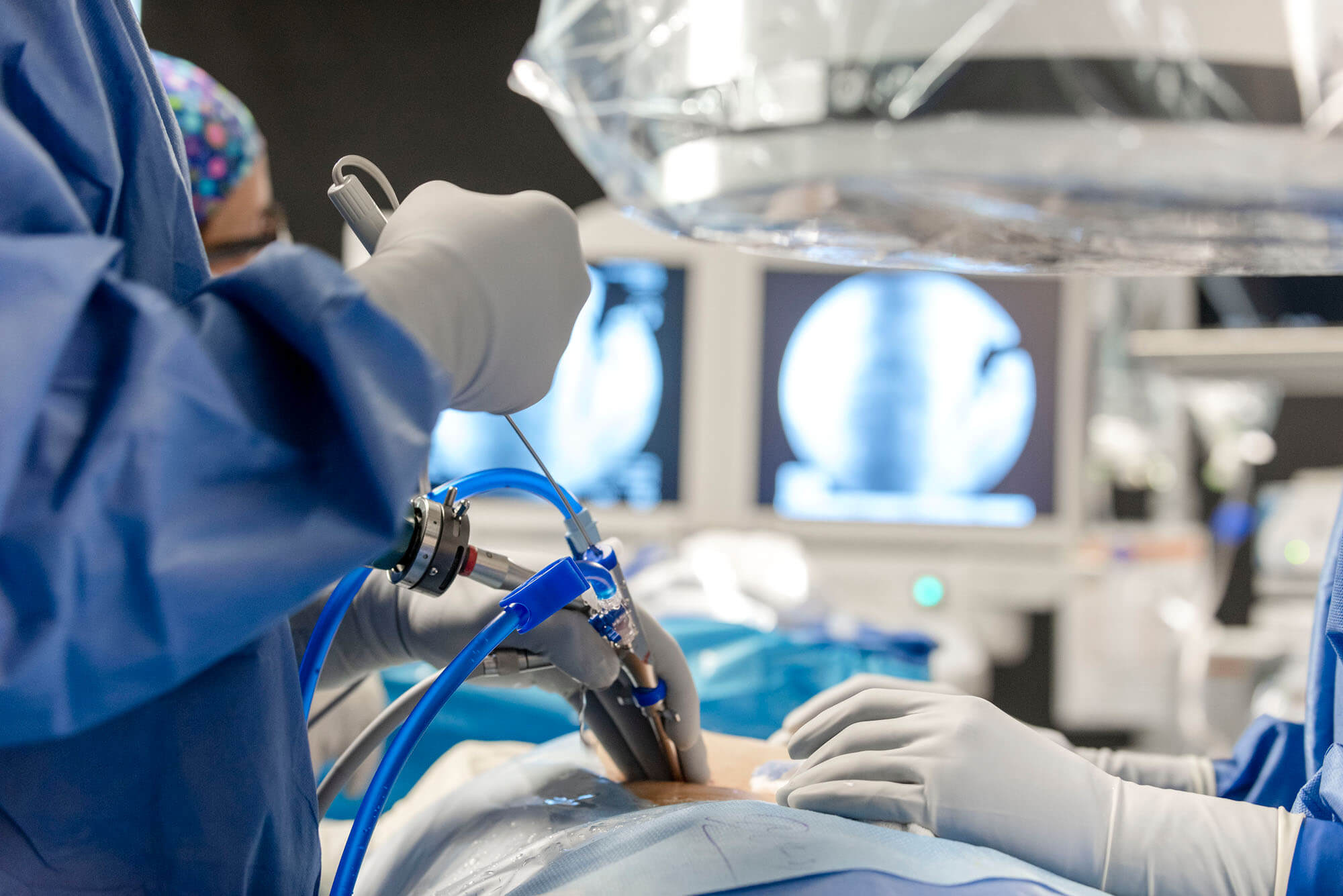 Pediatric Neurosurgery