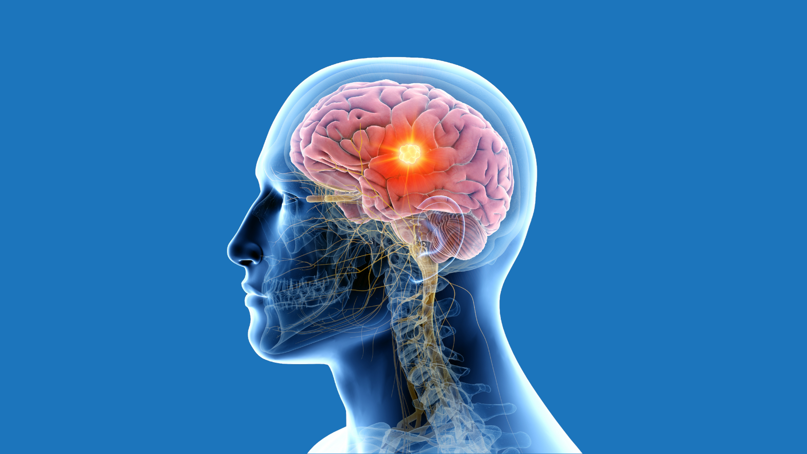Pediatric Neurosurgery